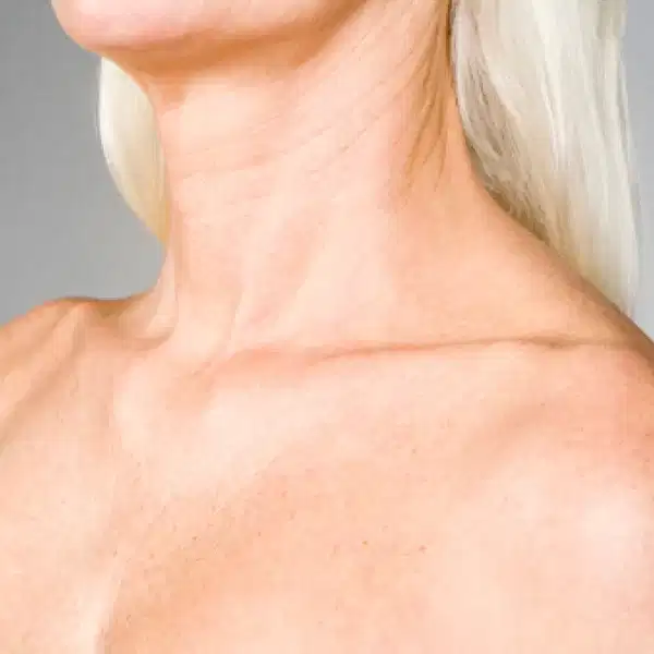 Cuello-escote