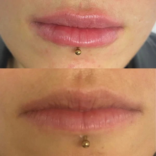 Hidratación-de-labios