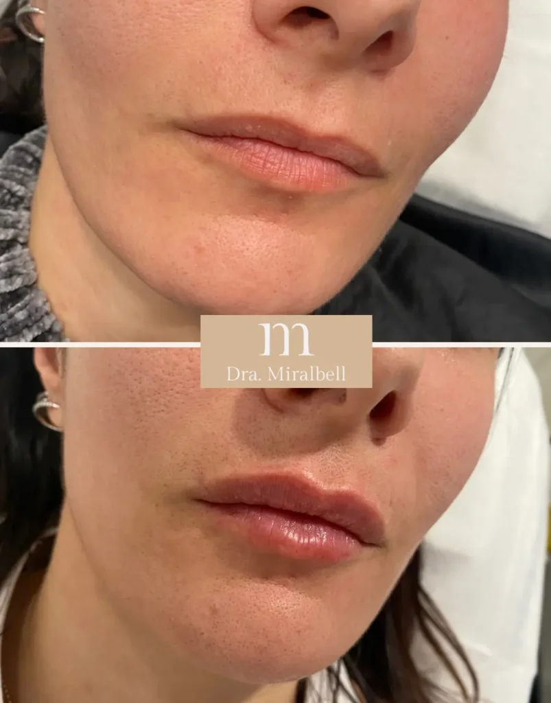 labios 3