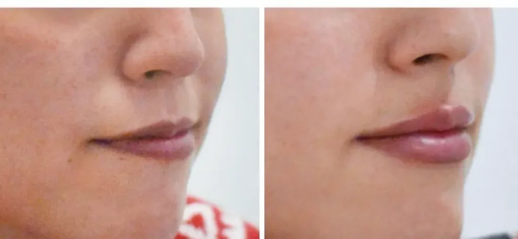 labios 5