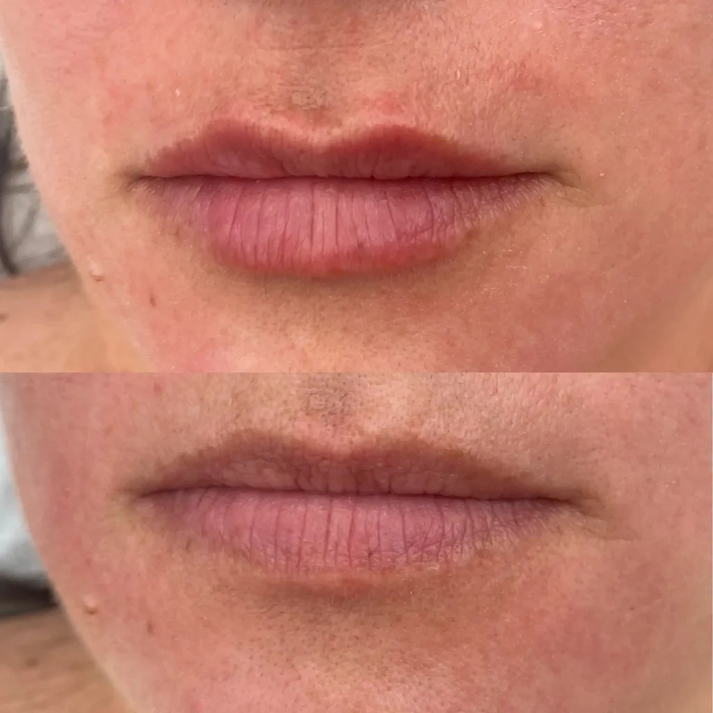 labios 7