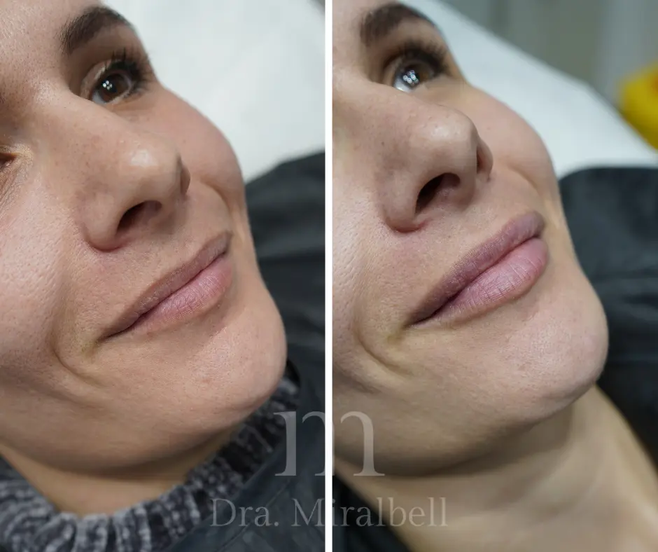 labios naturales